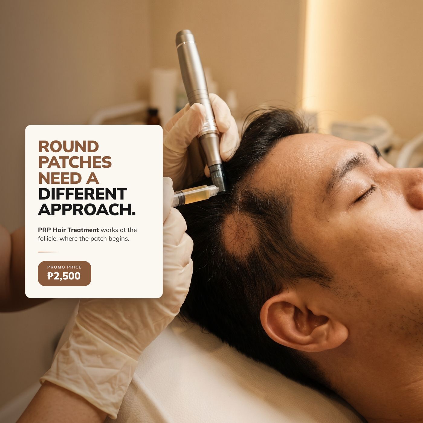 Roots & Co PRP campaign ad