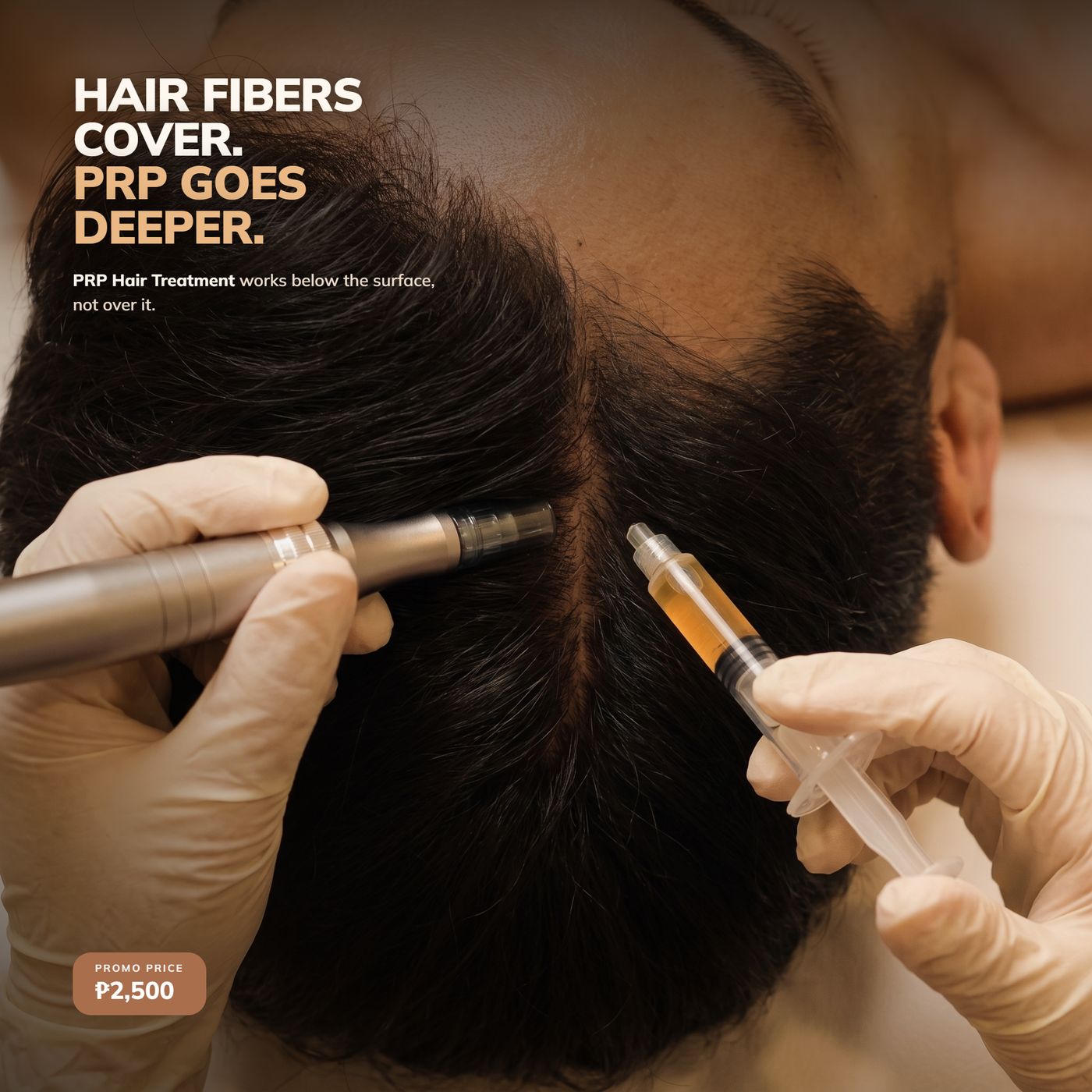 Roots & Co PRP ad — surface